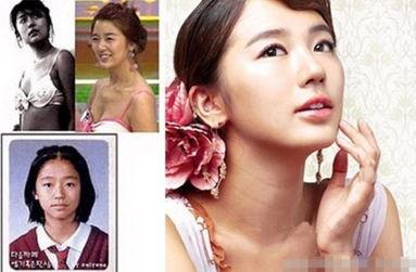 整容失败的韩国女明星,美丽代价与反思